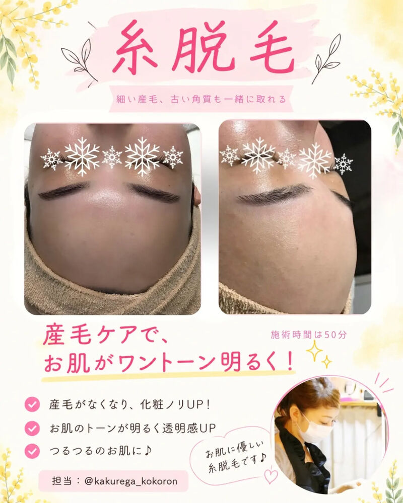 ブログ画像